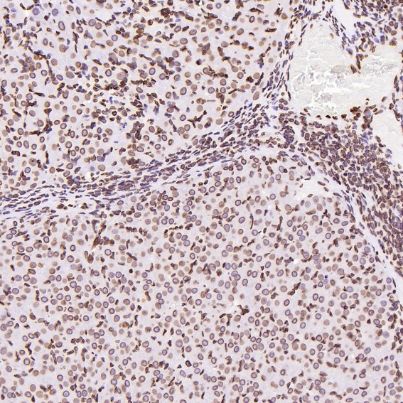 2 - Anti-Lamin B1 LMNB1 Rabbit Monoclonal Antibody ABO13908