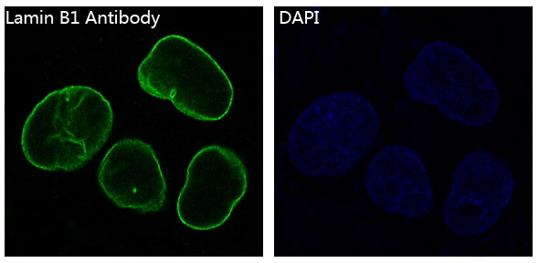 3 - Anti-Lamin B1 LMNB1 Rabbit Monoclonal Antibody ABO13908