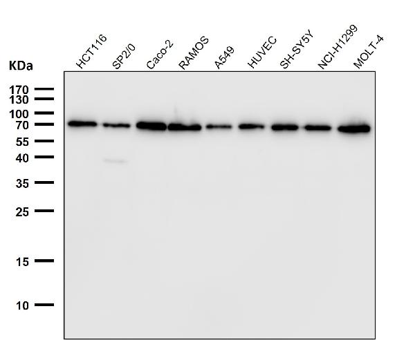 1 - Anti-Lamin B1 LMNB1 Rabbit Monoclonal Antibody ABO13908