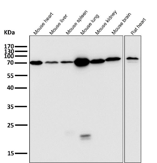 1 - Anti-Lamin B1 LMNB1 Rabbit Monoclonal Antibody ABO13908