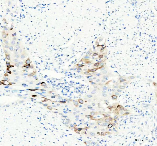 2 - Anti-Aurora B AURKB Rabbit Monoclonal Antibody ABO13909