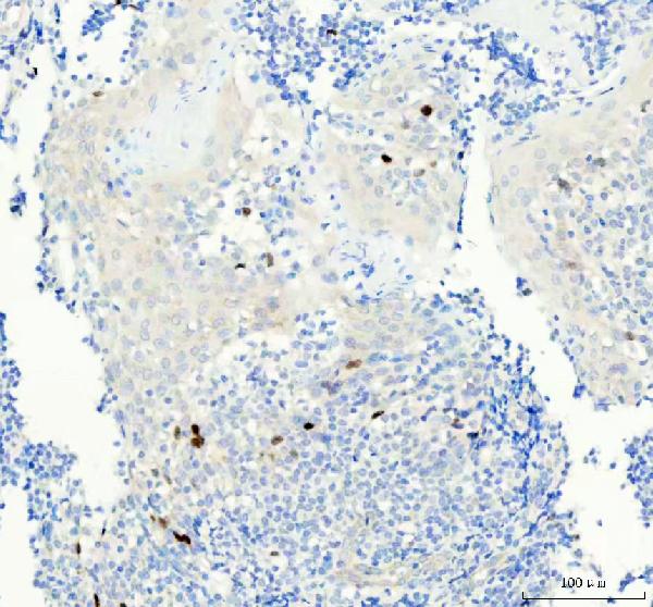 2 - Anti-Aurora B AURKB Rabbit Monoclonal Antibody ABO13909