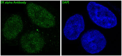 3 - Anti-ER alpha ESR1 Rabbit Monoclonal Antibody ABO13910