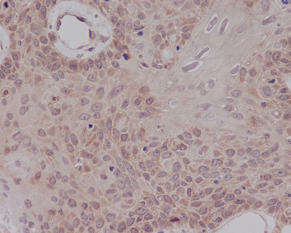 2 - Anti-ER alpha ESR1 Rabbit Monoclonal Antibody ABO13910