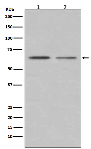 1 - Anti-ER alpha ESR1 Rabbit Monoclonal Antibody ABO13910