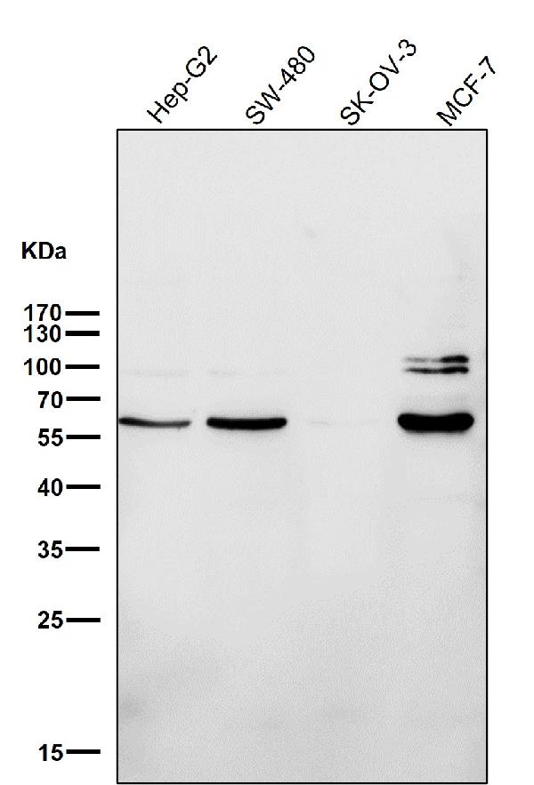 1 - Anti-ER alpha ESR1 Rabbit Monoclonal Antibody ABO13910