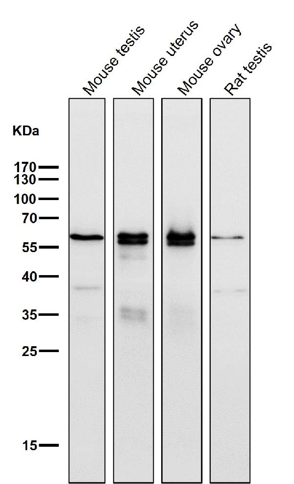 1 - Anti-ER alpha ESR1 Rabbit Monoclonal Antibody ABO13910