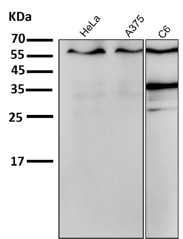 1 - Anti-ER alpha ESR1 Rabbit Monoclonal Antibody ABO13910