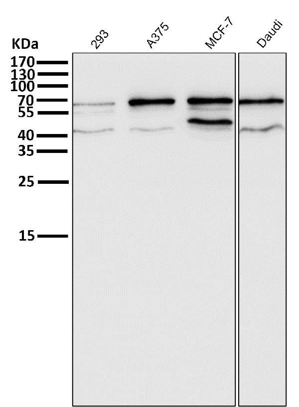 1 - Anti-ER alpha ESR1 Rabbit Monoclonal Antibody ABO13910