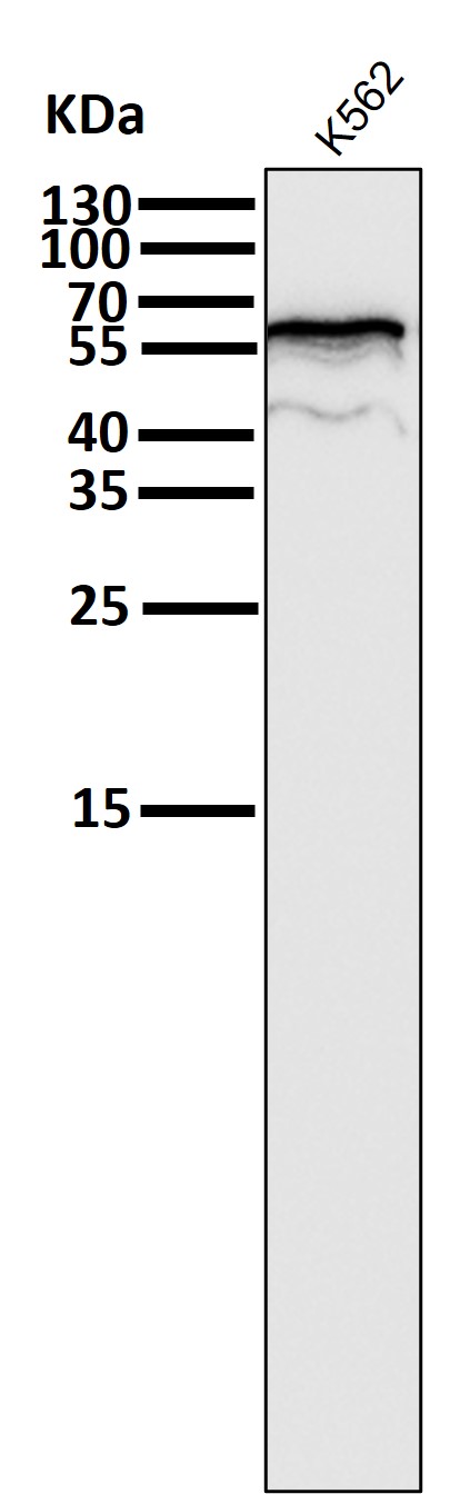 1 - Anti-ER alpha ESR1 Rabbit Monoclonal Antibody ABO13910