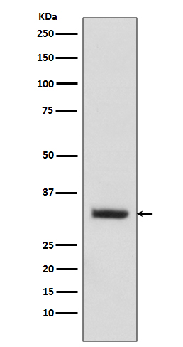 1 - Anti-C10orf63 ENKUR Rabbit Monoclonal Antibody ABO13911
