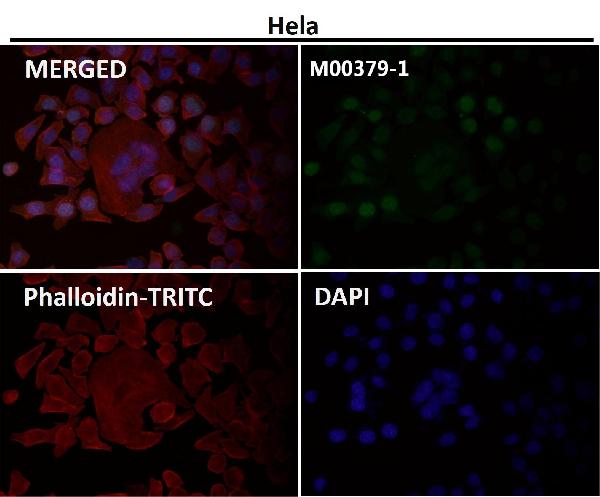 1 - Anti-Survivin BIRC5 Rabbit Monoclonal Antibody ABO13912