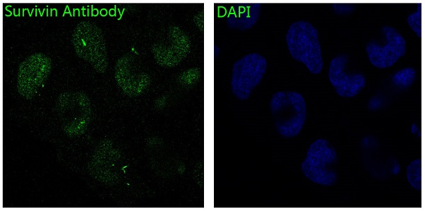 3 - Anti-Survivin BIRC5 Rabbit Monoclonal Antibody ABO13912