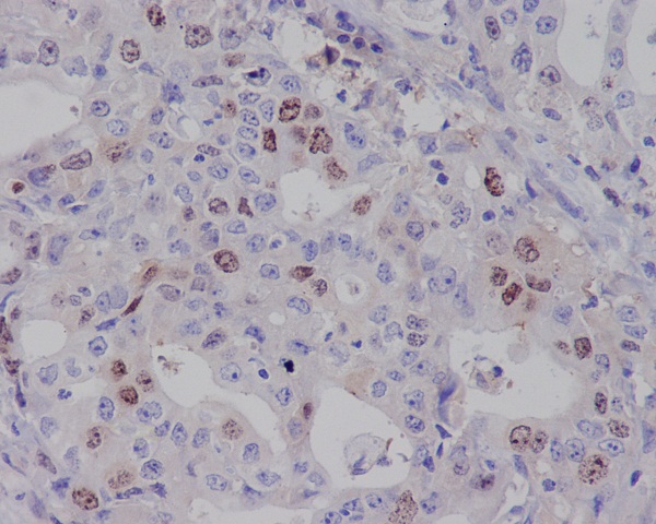 2 - Anti-Survivin BIRC5 Rabbit Monoclonal Antibody ABO13912