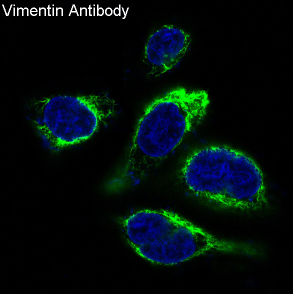 3 - Anti-Vimentin Rabbit Monoclonal Antibody ABO13913