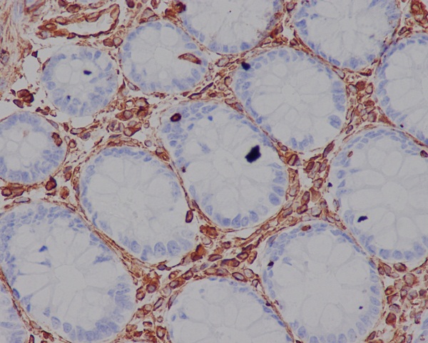 2 - Anti-Vimentin Rabbit Monoclonal Antibody ABO13913