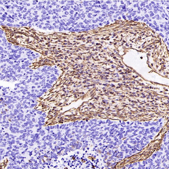 2 - Anti-Vimentin Rabbit Monoclonal Antibody ABO13913