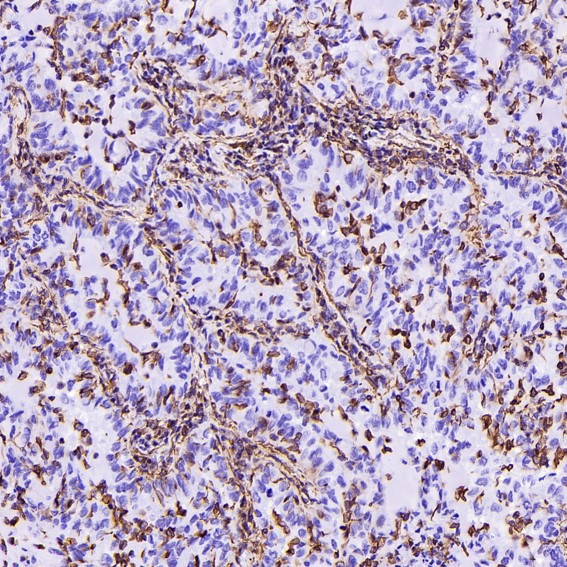2 - Anti-Vimentin Rabbit Monoclonal Antibody ABO13913