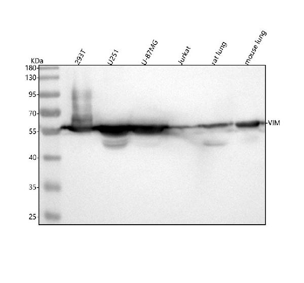 1 - Anti-Vimentin Rabbit Monoclonal Antibody ABO13913