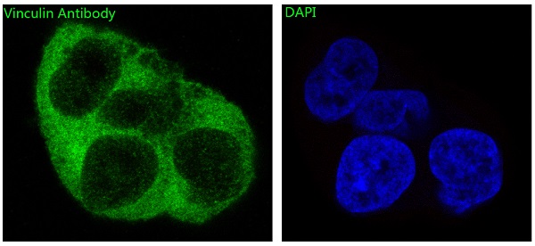 3 - Anti-Vinculin VCL Rabbit Monoclonal Antibody ABO13914