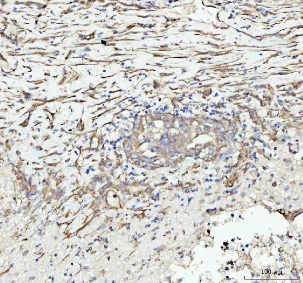 2 - Anti-Vinculin VCL Rabbit Monoclonal Antibody ABO13914