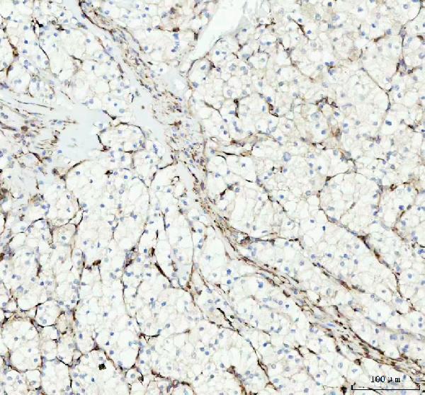 2 - Anti-Vinculin VCL Rabbit Monoclonal Antibody ABO13914