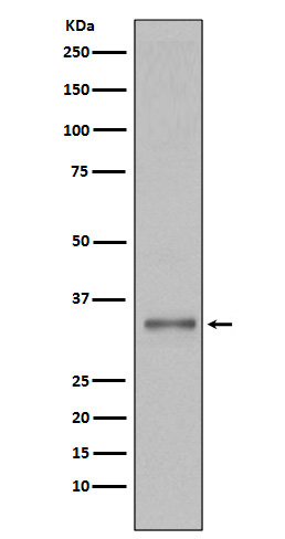 1 - Anti-Torsin A TOR1A Rabbit Monoclonal Antibody ABO13915