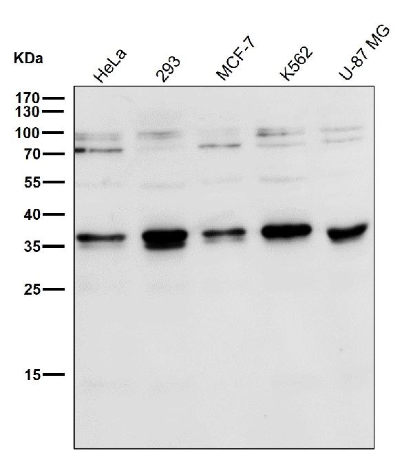 1 - Anti-Torsin A TOR1A Rabbit Monoclonal Antibody ABO13915