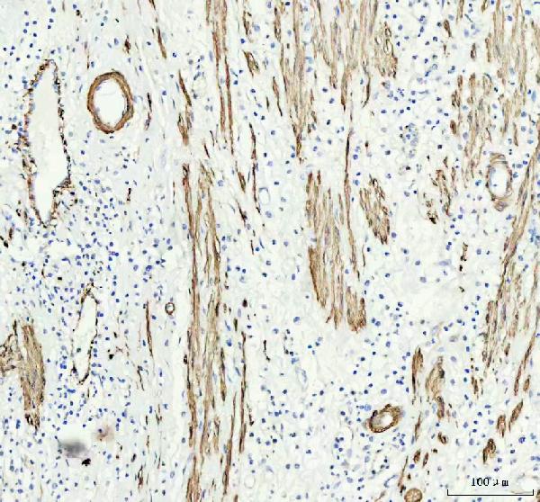 2 - Anti-Calponin CNN1 Rabbit Monoclonal Antibody ABO13916