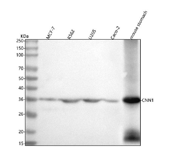 1 - Anti-Calponin CNN1 Rabbit Monoclonal Antibody ABO13916