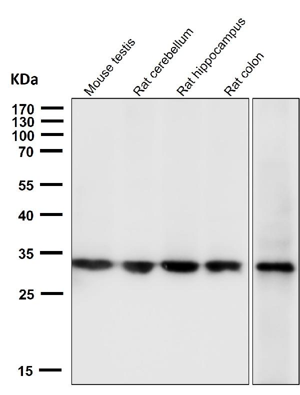 1 - Anti-Calponin CNN1 Rabbit Monoclonal Antibody ABO13916