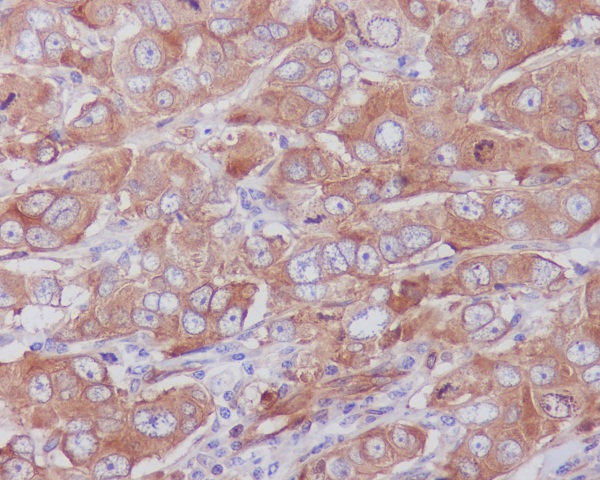 2 - Anti-Paxillin PXN Rabbit Monoclonal Antibody ABO13917