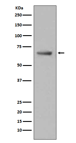 1 - Anti-Paxillin PXN Rabbit Monoclonal Antibody ABO13917