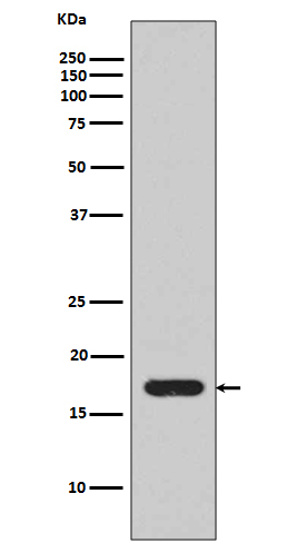 1 - Anti-IL1 beta Rabbit Monoclonal Antibody ABO13918