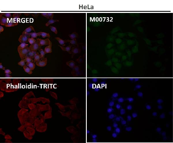 1 - Anti-p95/NBS1 NBN Rabbit Monoclonal Antibody ABO13919