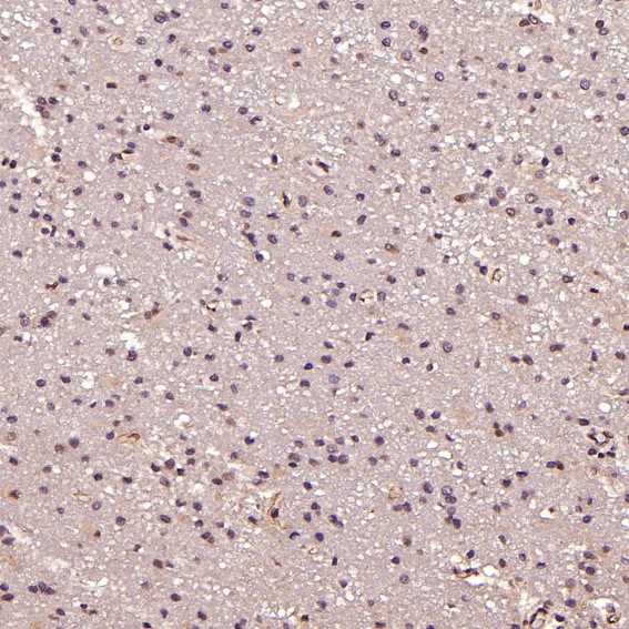 2 - Anti-p95/NBS1 NBN Rabbit Monoclonal Antibody ABO13919