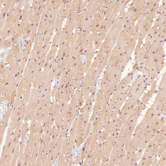 2 - Anti-p95/NBS1 NBN Rabbit Monoclonal Antibody ABO13919
