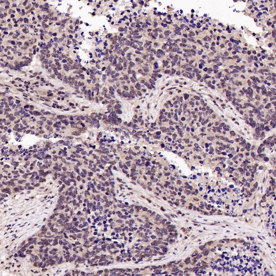 2 - Anti-p95/NBS1 NBN Rabbit Monoclonal Antibody ABO13919