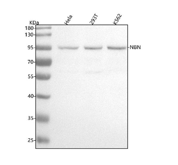 1 - Anti-p95/NBS1 NBN Rabbit Monoclonal Antibody ABO13919