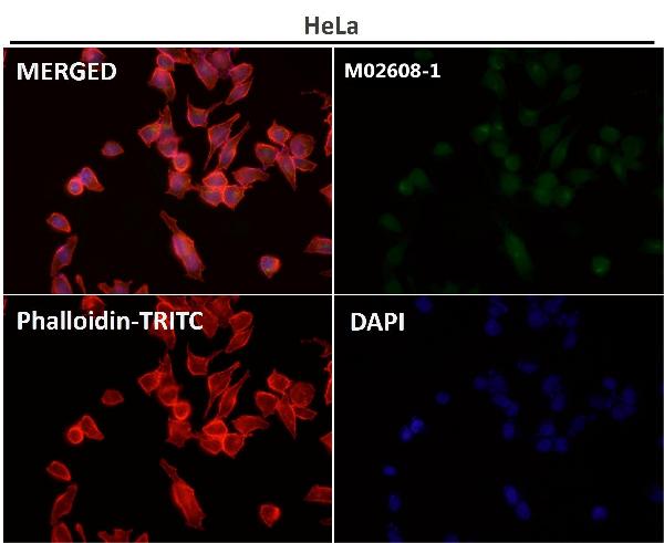 1 - Anti-JNK1/2/3 MAPK8 Rabbit Monoclonal Antibody ABO13920