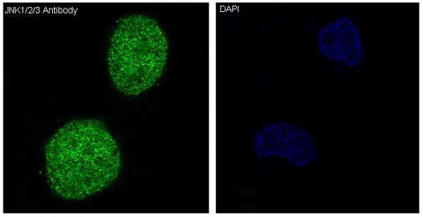 3 - Anti-JNK1/2/3 MAPK8 Rabbit Monoclonal Antibody ABO13920