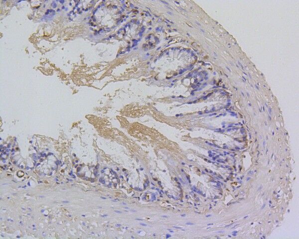 2 - Anti-Survivin Birc5 Rabbit Monoclonal Antibody ABO13921