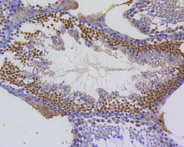 2 - Anti-Survivin Birc5 Rabbit Monoclonal Antibody ABO13921