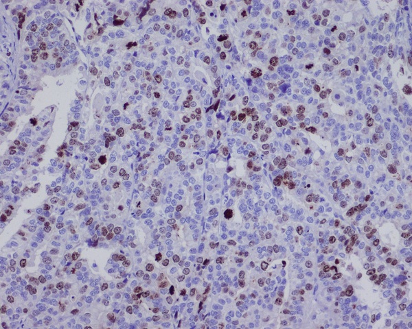 2 - Anti-Survivin Birc5 Rabbit Monoclonal Antibody ABO13921