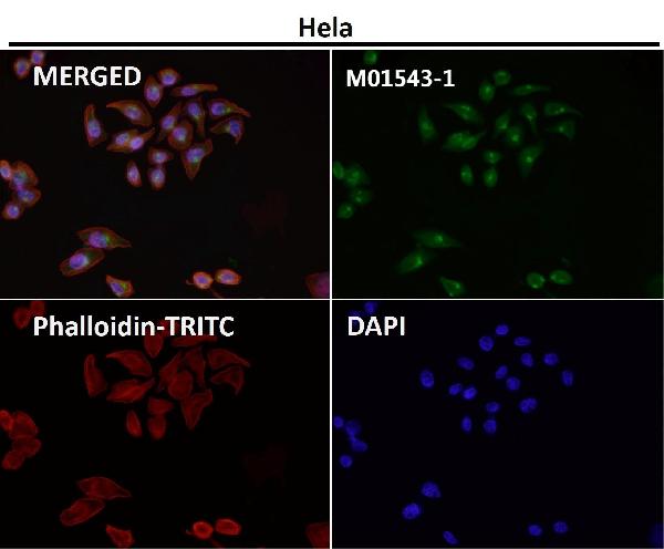 1 - Anti-MAP1LC3A/Lc3A Rabbit Monoclonal Antibody ABO13923