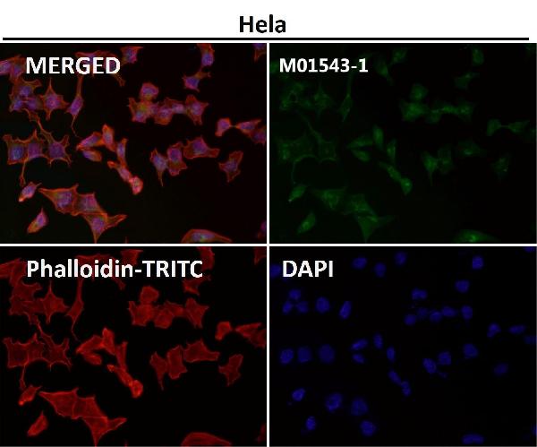 1 - Anti-MAP1LC3A/Lc3A Rabbit Monoclonal Antibody ABO13923
