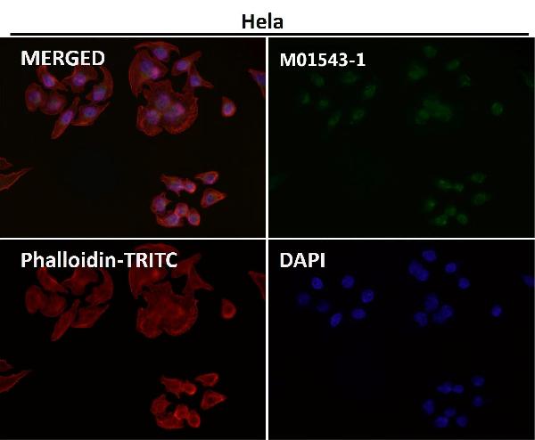 1 - Anti-MAP1LC3A/Lc3A Rabbit Monoclonal Antibody ABO13923