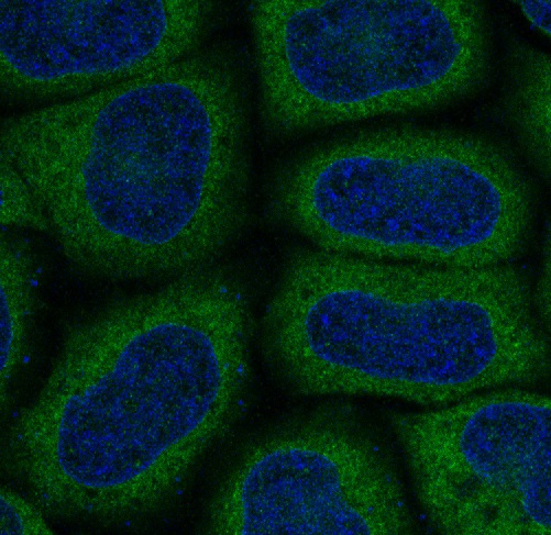 3 - Anti-MAP1LC3A/Lc3A Rabbit Monoclonal Antibody ABO13923