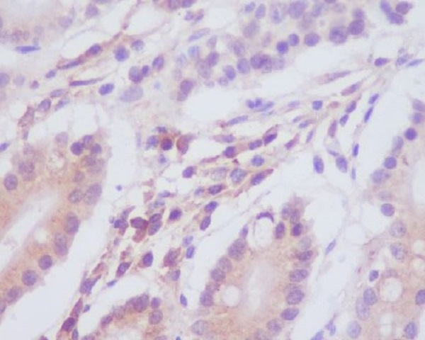 2 - Anti-MAP1LC3A/Lc3A Rabbit Monoclonal Antibody ABO13923