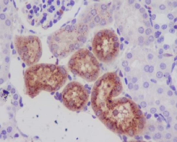 2 - Anti-Lysozyme LYZ Rabbit Monoclonal Antibody ABO13924